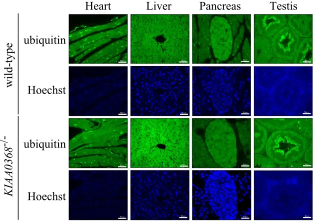 Figure 7 | Ubiquitin staining on KIAA0368-deficient mice tissues, 