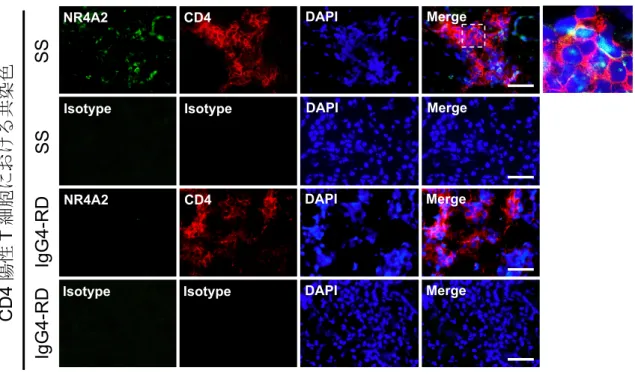 図 8   口唇唾液腺（ labial salivary gland: LSG）の蛍光免疫染色：NR4A2、CD4  シェーグレン症候群（Sjögren's syndrome: SS）患者と IgG4 関連疾患（IgG4-related  disease: IgG4-RD）患者の LSG 切片を用い、NR4A2 と CD4 の二重染色を行った。
