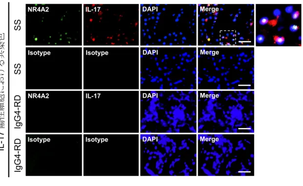 図 9   口唇唾液腺（labial salivary gland: LSG）の蛍光免疫染色：NR4A2、IL-17  シェーグレン症候群（Sjögren's syndrome: SS）患者と IgG4 関連疾患（IgG4-related  disease: IgG4-RD ）患者の LSG 切片を用い、 NR4A2 と IL-17 の二重染色を行った。