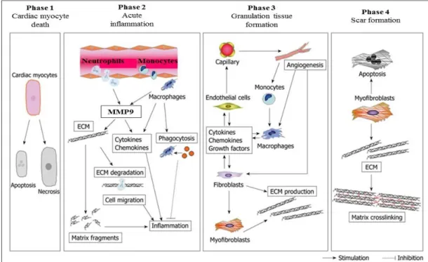 Figure  1.  Phases  of  cardiac  healing  and  remodeling  process  after  MI: 