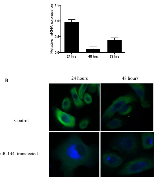 Figure 4. MiR-144 transfection decreases ABCA1 expression in HPEKs. (A) MiR-144  transfection decreased the mRNA levels of ABCA1