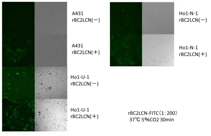 図 ４ ： rBC2LCN 認 識 糖 鎖 陽 性 細 胞 と 陰 性 細 胞 ソ ー テ ィ ン グ 後 に ラ イ ブ セ ル イ メ ー ジ ン グ に て rBC2LCN 認 識 糖 鎖 の 発 現 状 態 を 検 討  