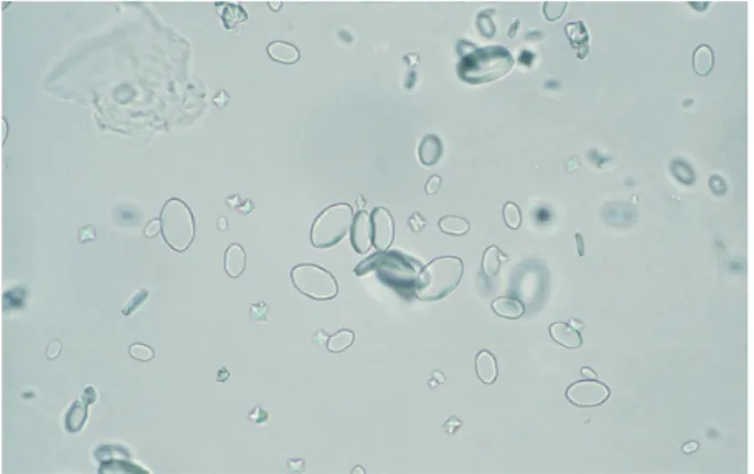 Figure 3.357  シュウ酸カルシウム結晶  40×   Alizarin red 染色