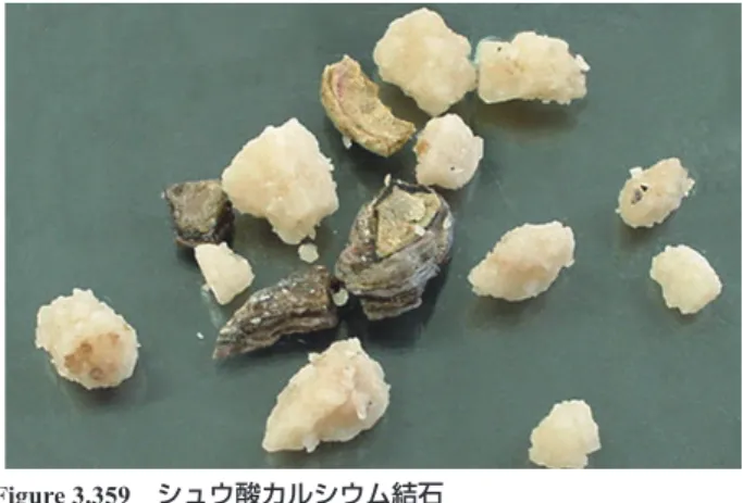 Figure 3.361*  尿酸結晶  40×  無染色