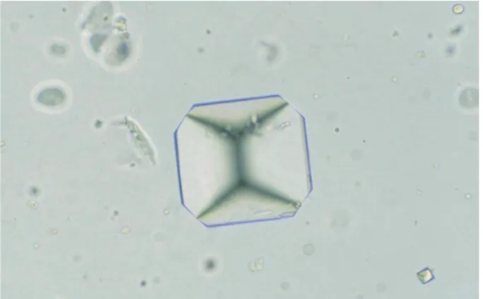 Figure 3.369  リン酸アンモニウムマグネシウム結晶   40×   無染色