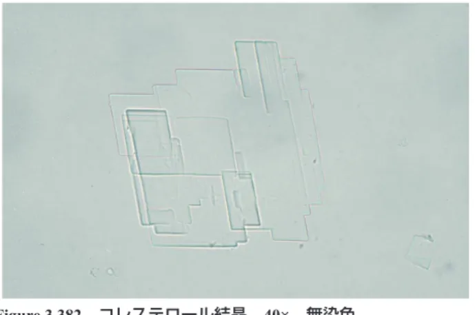 Figure 3.381  コレステロール結晶  40×  無染色