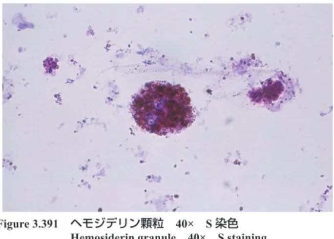 Figure 3.390  ヘモジデリン顆粒  40×   S 染色