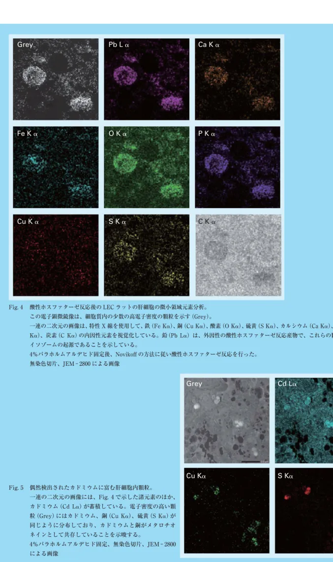 Fig. 4  酸性ホスファターゼ反応後の LEC ラットの肝細胞の微小領域元素分析。   この電子顕微鏡像は、細胞質内の少数の高電子密度の顆粒を示す（Grey）。   一連の二次元の画像は、特性 X 線を使用して、鉄（Fe K␣）、銅（Cu K␣）、酸素（O K␣）、硫黄（S K␣）、カルシウム（Ca K␣）、リン（P  K␣）、炭素（C K␣）の内因性元素を視覚化している。鉛  （Pb L␣）は、外因性の酸性ホスファターゼ反応産物で、これらの顆粒がラ イソゾームの起源であることを示している。   4％パ