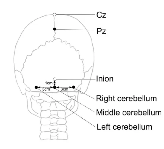 Fig. 1. 2 An illustration of coil position. Filled circle indicate  position  of  center  of  double  cone  coil  and  open  circle  indicate  reference point for the coil position