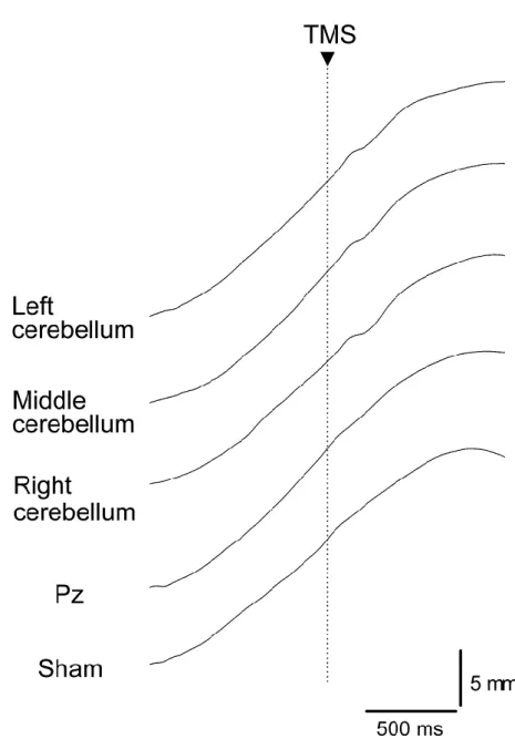 Fig. 1. 4 Specimen record of the averaged trajectory of the fingertip  displacement. A dashed vertical line indicates TMS onset