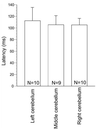 Fig. 1. 6 Latency of fluctuation of finger movement induced by TMS. 