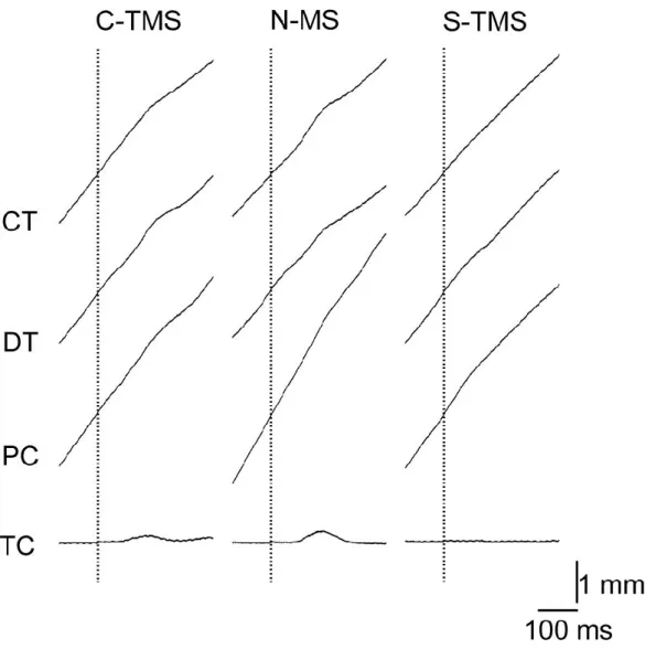 Fig. 2. 5 Specimen record of averaged trajectory of fingertip  displacement. Dashed vertical lines indicate the MS onset