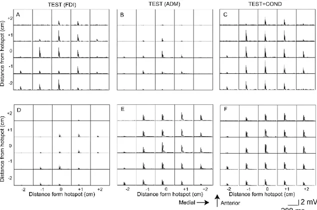 Fig. 2.  5  Specimen  EMG  traces.  Each  trace  indicates  the average  of  the  six  rectified  EMG  traces in the time window between the period 110 ms before TMS and the period 240 ms after  TMS