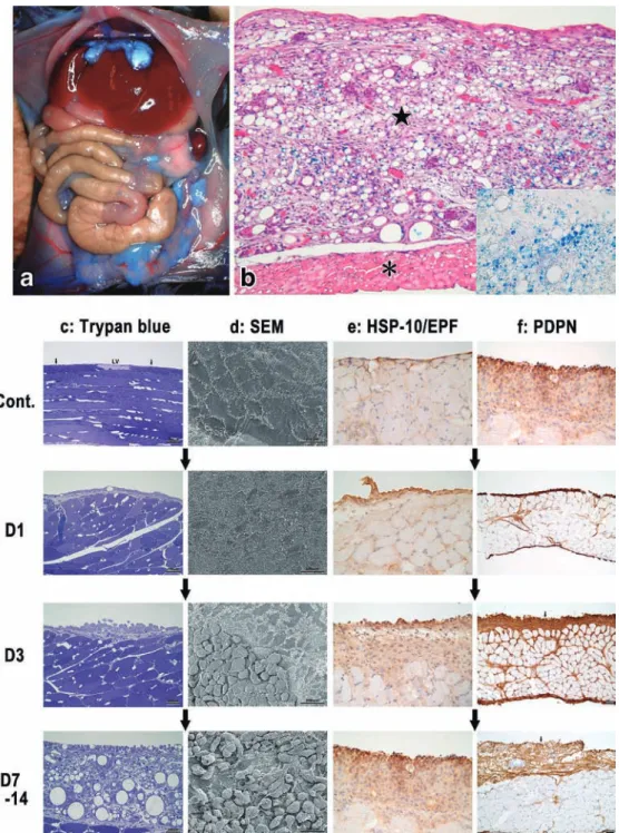 Figure 8 Development of lymphangiomas induced by a peritoneal FIA injection in mice.