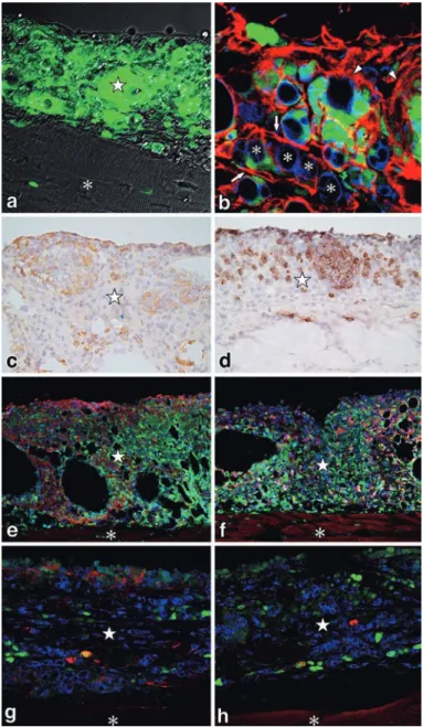 Figure 10 Involvement  of  bone  marrow-derived  intraperitoneal  cells  in  FIA-induced  lymphangiomas.