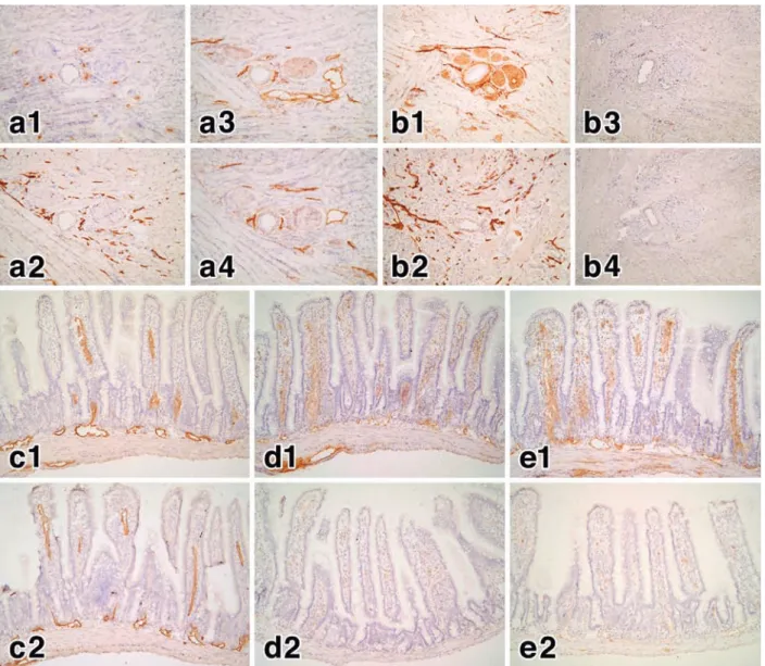 Figure 5 Effects  of  Thy-1  background  and  phospholipase  C  treatment  on  the  antigens  recognized by LA102 and other antibodies.