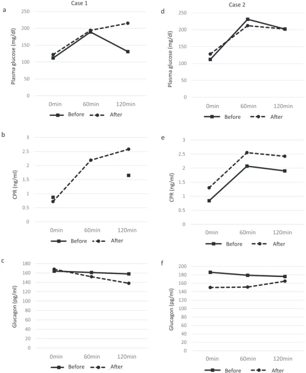 Fig. 2 Transition  of  each  parameter  in  MTT  before  and  after  administration  of  DPP-4  inhibitor a and d, plasma glucose; b and e, CPR; c and f, glucagon.  a, b, c were measured in Case 1. d, e, f were measured in Case 2.0501001502002500ศ60ศ120ศᢞ୚