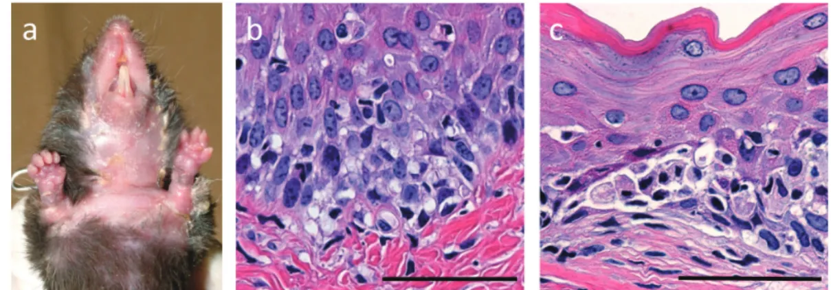 Figure 3. Pathogenic activity of Dsg3H1 T cells to induce interface dermatitis. CD4 + T cells were prepared from Dsg3H1 mouse and transferred with Dsg3 -/- B cells into Rag2 -/- mouse