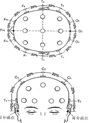 Figure 3-2 10-20 法の電極配置法