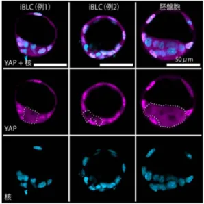 図 3 iBLC での転写因子 YAP の細胞内局在 