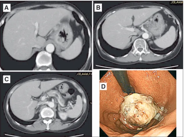 Table 2 Laboratory data on re-admission