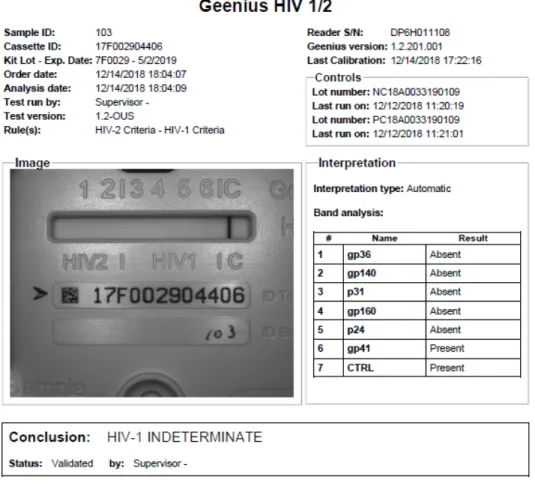 図 5-2 Geenius リーダーを用いた判定結果の例（HIV-1 判定保留） 