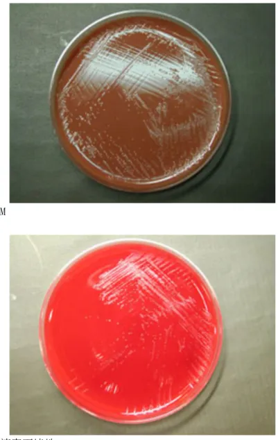 図 6  淋菌( N.gonorrhoeae ) の平板上の様子 