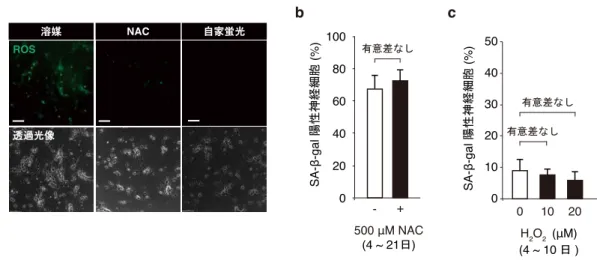 図 3-8. ROS 産生量は SA-β-gal  陽性神経細胞の出現頻度に影響を与えない  a)  培養 7 日目の海馬神経細胞において、500 μM NAC の 1 時間前処理することで ROS 産生量が顕著に減 少した。1μM CM-H2-DCFDA  存在下で細胞を 40 分間培養した後の代表的な蛍光画像(ROS、緑)および 透過光像を示す。スケールバー90 μm  b)  培養 4 日目から 21 日まで、持続的に 500 μM NAC の存在下(+)または非存在下(-)で培養を行った海 馬神経細