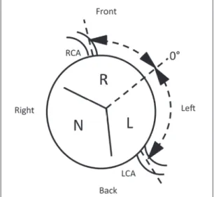 Fig. 3　Schema of the aortic valve cited from  the reference  ₃ .