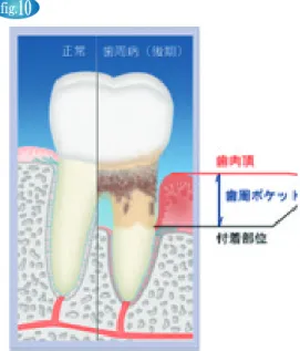 fig. 11 fig. 12 fig. 13