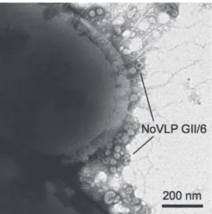 図 3   Enterobacter cloacae  SENG-6 に捕捉されたノロウイルス中空粒子の電子顕微鏡画像．