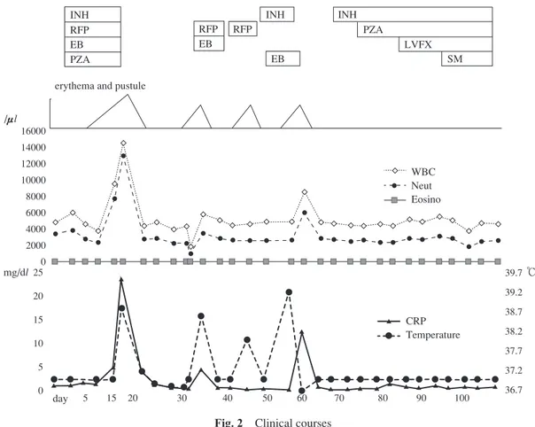 Fig. 3 Clinical appearance of the back : a : diffuse erythema with scales.  b : military pustules inconsistent  with pores in the skin.16000140001200010000800060004000200002520151050 39.739.238.738.237.737.236.7 ℃WBCNeutEosinoCRPTemperaturemg/dl/μl
