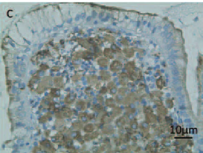 Fig. 6 Histological characteristics of enteric M. avium infec- infec-tion in patients with AIDS.