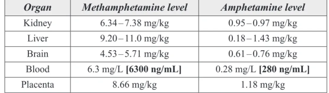 Table 7. Methamphetamine and Amphetamine Distribution in Twin Boys Exposed to  Methamphetamine In Utero Five Hours Before Birth.