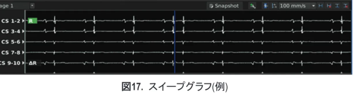 表 2.  クリッピングプレーンのドロップダウンの選択肢 メニューの選択肢 操作 Flip を選択する クリッピングプレーンを反転し、クリッピングされた部分と表示された部分を入れ替える(クリッピングされた対象物が表示され、表示され ていた対象物がクリッピングされる ) 。 あらかじめ定義されている 3 つの面 (Coronal 、 Sagittal 、 Transverse) のいずれかを選択する あらかじめ設定されている向きから目的の向きを選びマップを表示する。 Reset を選択する 近接しているクリッ