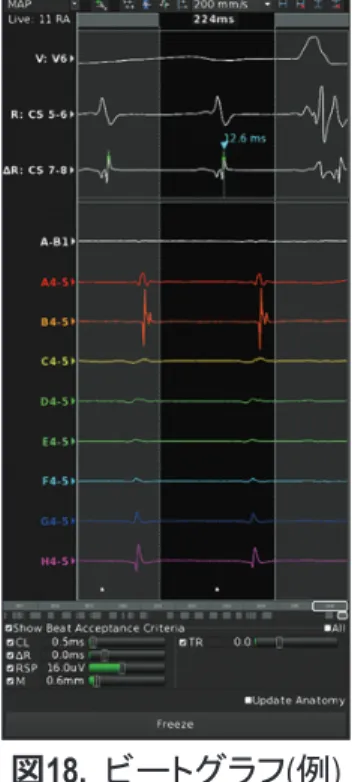 図 18.  ビートグラフ ( 例 ) レビューグラフ (Beat Review Graph)