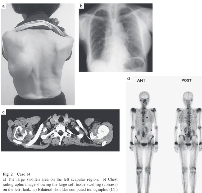 Fig. 2 Case 14