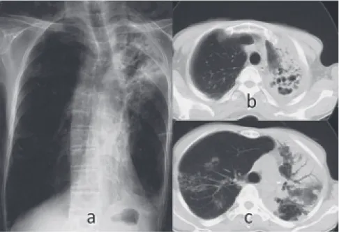 Fig. 2 Clinical course of case 1