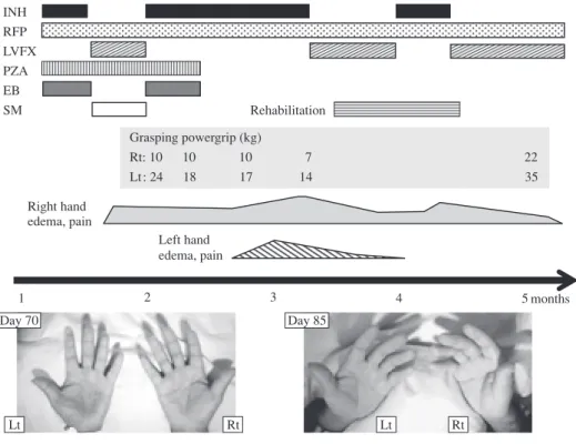 Fig. 2 Clinical course of Case 1