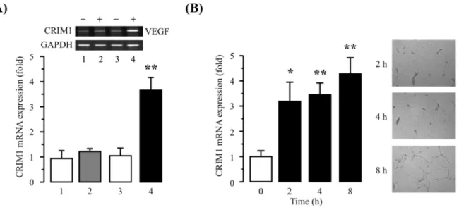 Fig. 2 CRIM1 mRNA expression in HUVECs. 