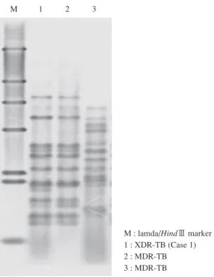 Fig.  2　Restriction fragment length polymorphism (RFLP)  of one XDR-TB case and two MDR-TB cases occurred in the  same hospital.