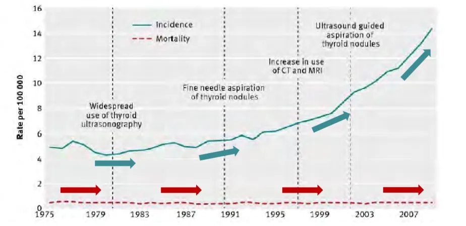 Fig 2 Incidence of and mortality from thyroid cancer in the US, 1975-20093 and advent of new technologies