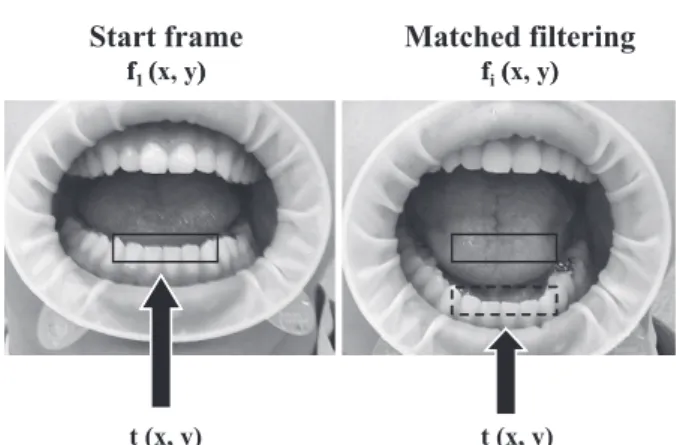 Fig 2 TV camera for taking mandible movement setting by standardize photography.