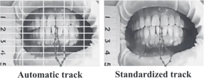 Fig 6 Mandibular movement track variations of 3 times consen- consen-tively and Irregularity of 3 mandibular movement track.