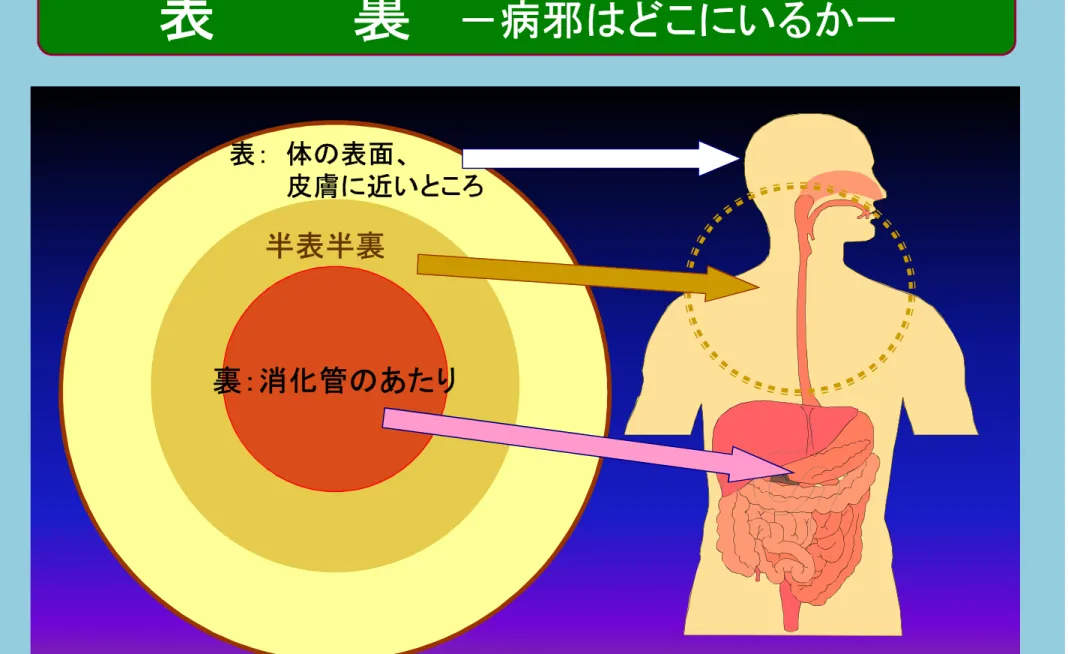 表 裏 －病邪はどこにいるかー