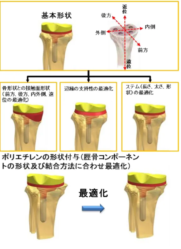 図 D.2 に脛骨コンポーネントのカスタム化のイメージを示す。 