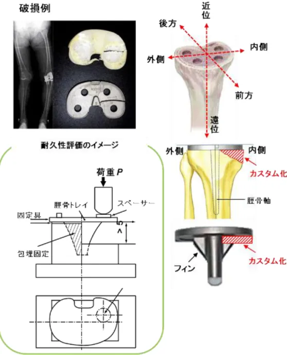 図 G.3  脛骨コンポーネントのカスタム化に対する力学試験の考え方 