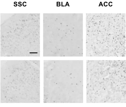Fig. 4.    マウスの後肢足底へのカプサイシン投与による脳内 c-Fos 発現を示す典型的な 顕微鏡像．マウスの左側線条体に生理食塩水もしくは 6-OHDA を局所注入し，その 14 日後に右後肢足底へカプサイシン  (1.6 µg)  を投与した．投与 2 時間後に組織を固定し て脳薄切片を作製し，免疫染色法により体性感覚野  (SSC)，扁桃体基底外側核  (BLA)， 前部帯状回皮質  (ACC)，中脳水道灰白質  (PAG)，延髄吻側腹内側部  (RVM)  および青斑 核  (LC)を含む