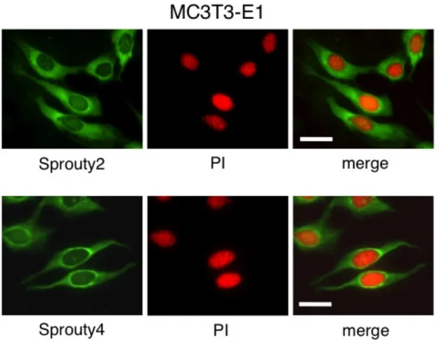 図  4 : MC3T3-E1  細胞における   Sprouty2  と  Sprouty4  の局在