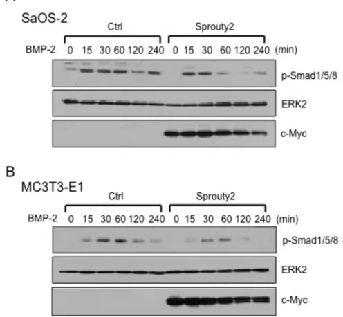 図  7 : Sprouty2  の  Smad  のリン酸化に対する影響